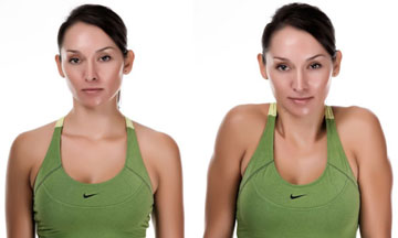 Neck Shrugs, nonsurgical treatment for neck pain Monterey