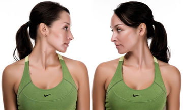 Neck Turn, nonsurgical treatment for back pain Silicon Valley